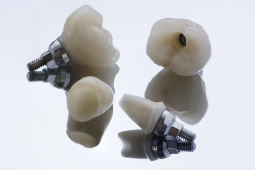 коронки для имплантации зубов